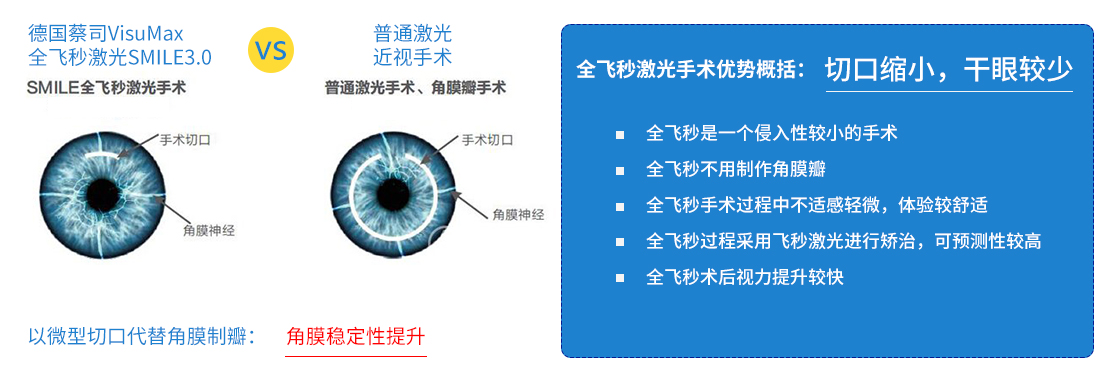 全飞秒激光近视矫治术